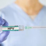 HPV Nedir, Neden Olur? HPV Nasıl Bulaşır? HPV Virüsü Belirtileri Nelerdir?